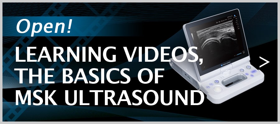 -OPEN!- LEARNING VIDEOS, THE BASICS OF MSK ULTRASOUND