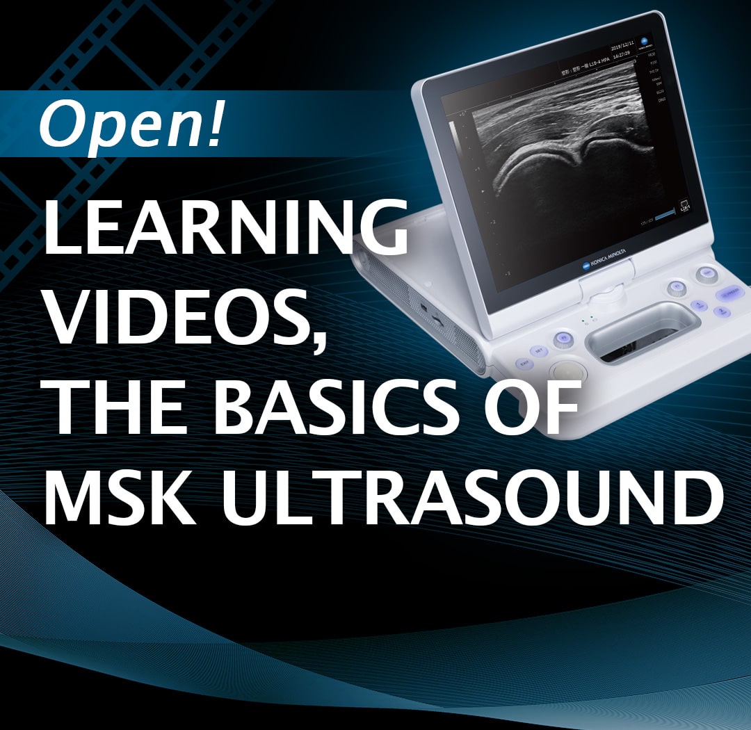 -OPEN!- LEARNING VIDEOS,THE BASICS OF MSK ULTRASOUND