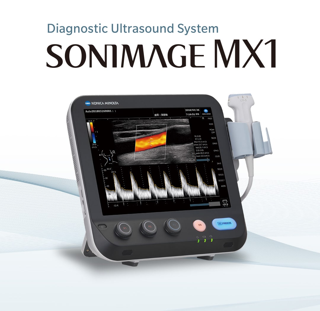 SONIMAGE MX1