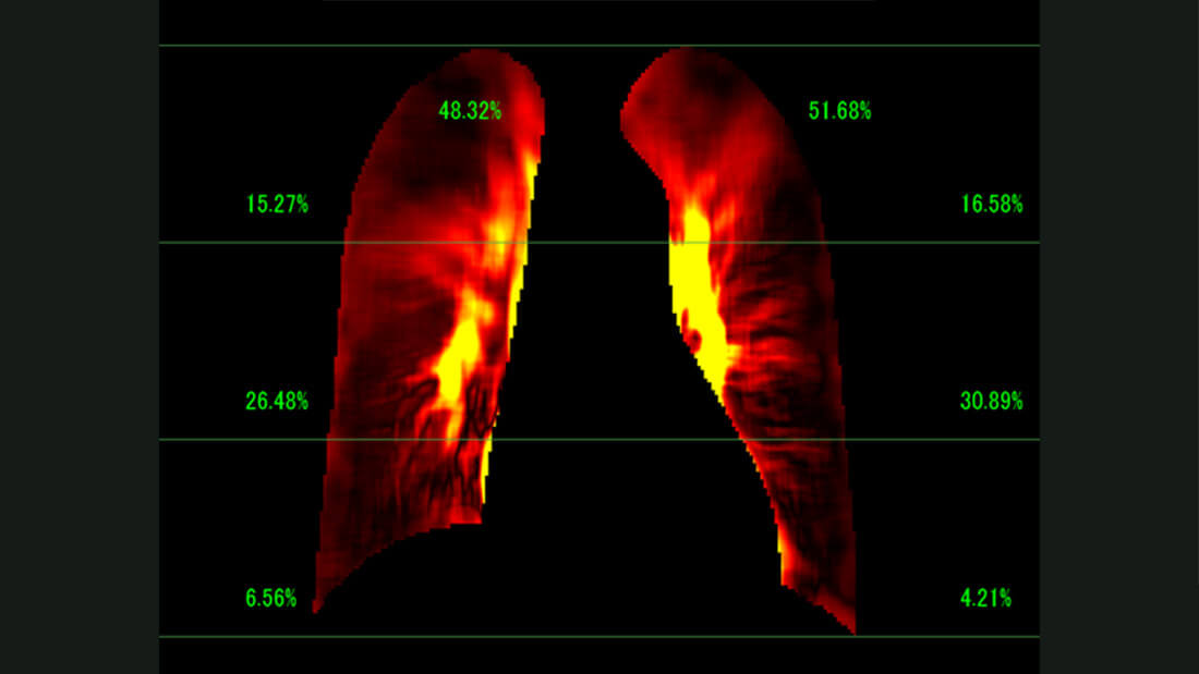 PH2-MODE (Option)