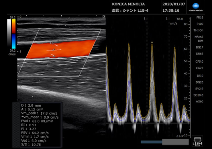 Vascular NAVI