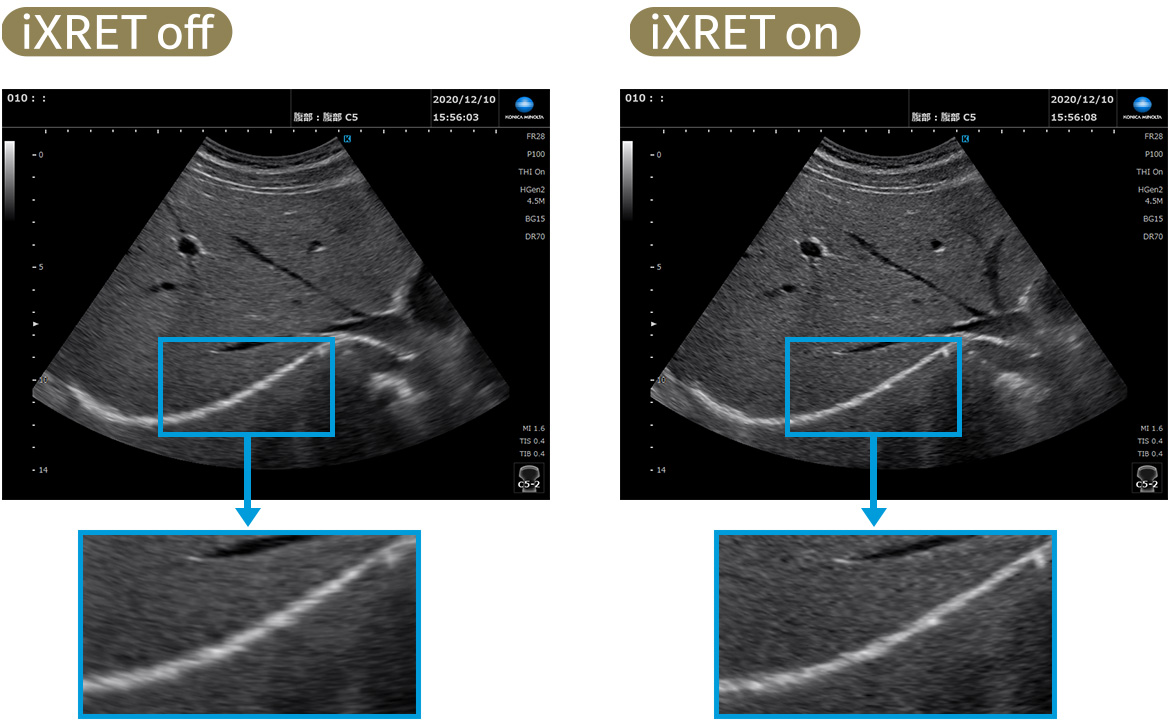 B-mode image