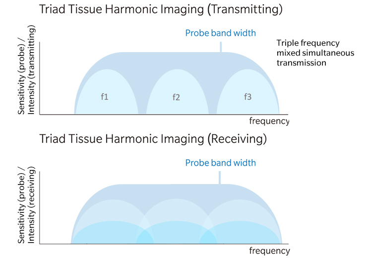 T2HI Triad Tissue Harmonic Imaging