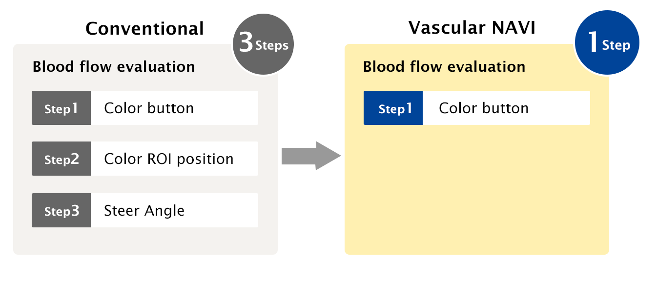 Vascular NAVI achieves Easy to use vascular ultrasound