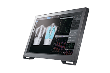 胸部単純X線検査において動画撮影を実現する　デジタルX線動画撮影システム