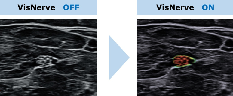 「VisNerve(ビズナーブ)」機能ONとOFFの比較画像