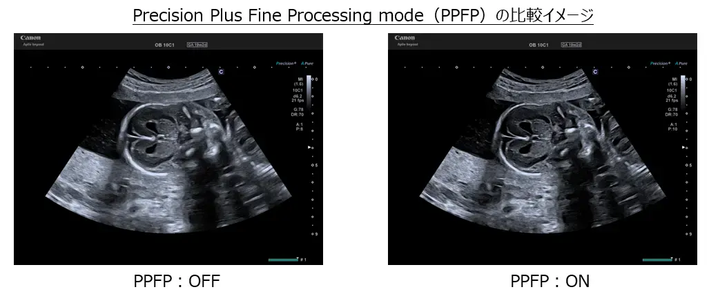 Precision Plus Fine Processing mode（PPFP）の比較イメージ