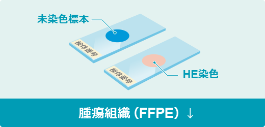 サムネイル：腫瘍組織（FFPE）