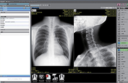 写真：医療画像情報システム