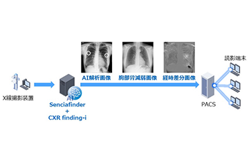 AIで医師の負担軽減に寄与する胸部X線画像診断支援ソフトウェア「CXR finding-i」