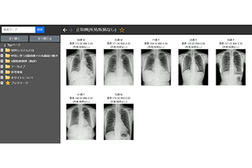 X線動画像のデジタル症例集「DDRAtlas Ver. 1.0」を公開